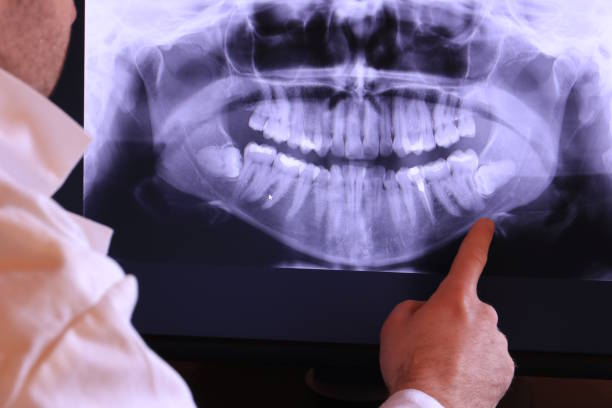 Best Mobile Emergency Dentist in Center, TX